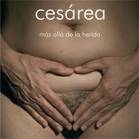 Cesárea | DD.AA.