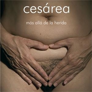Cesárea | DD.AA. | Cooperativa autogestionària
